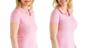 Breast lift and implants in Sacramento